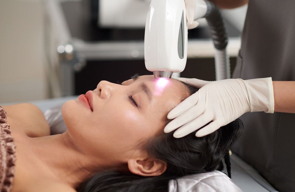 Qu’est-ce que le laser resurfaçant, ce soin dont raffolent les Coréennes pour une peau éclatante ?