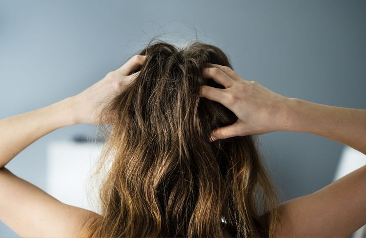 Psoriasis à la racine des cheveux : ces gestes surprenants du quotidien qui peuvent le déclencher