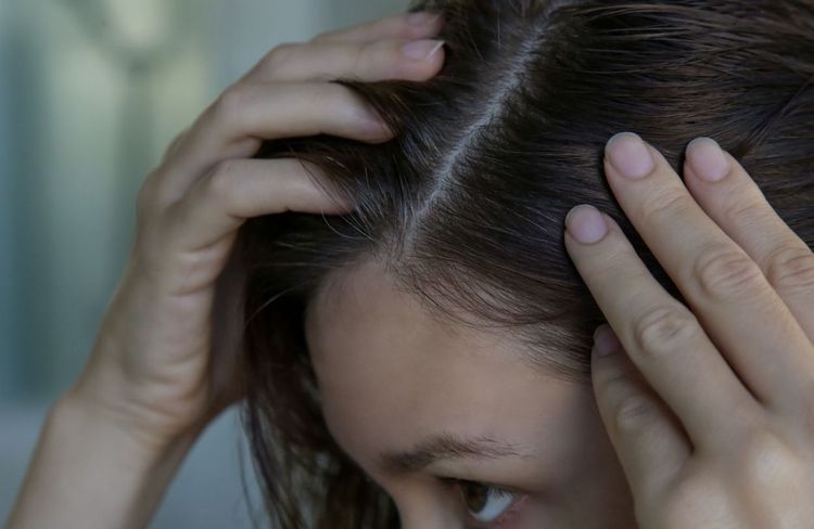 Pourquoi les 20-30 ans ont-ils des cheveux blancs de plus en plus tôt ?
