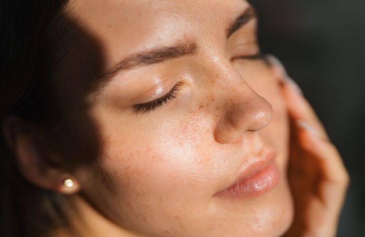 Polynucléotides : tout savoir sur ces injections qui améliorent la qualité de la peau