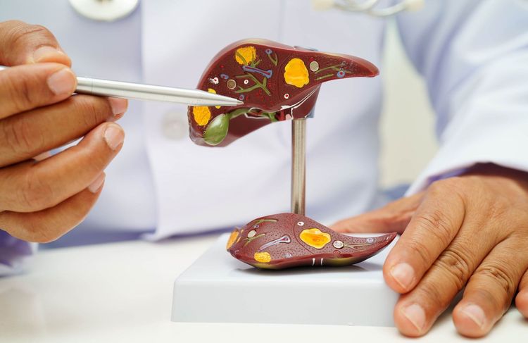 Ces facteurs qui pourraient permettre d'éviter 15 millions de cancers du foie