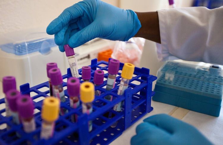 Sidaction : pourquoi la lutte contre le sida est fragilisée cette année