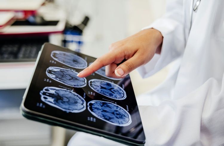 Le cerveau des psychopathes a une particularité, selon cette étude