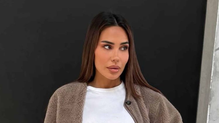 "Une opération relativement lourde" : Milla Jasmine complexée, elle se fait refaire le visage !