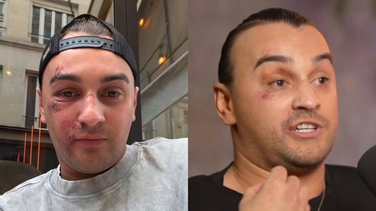 "Je me suis dit, je vais y passer" : Kilian (Qui veut épouser mon fils ?) raconte l’agression homophobe qu’il a subie
