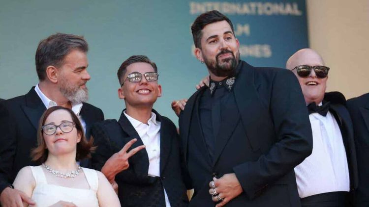 Artus : un acteur de son film Un p'tit truc en plus abandonné par ses parents à cause de son trouble