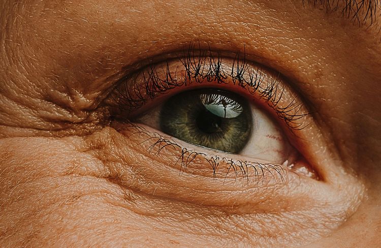 La greffe de sourcils, comment ça marche ?