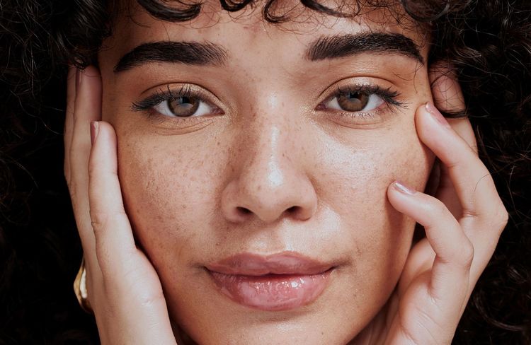 Acné : les femmes plus touchées que les hommes dans le monde