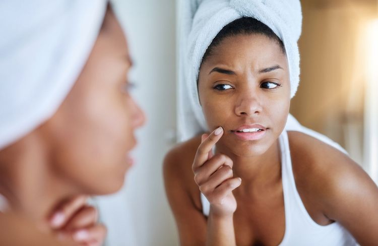 Acné : ce soin anti-imperfections cumule plus de 50 millions de vues sur les réseaux