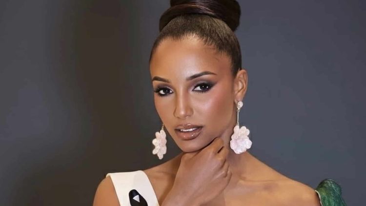 Fracture, hémoragie intracrânienne... : Miss Jamaïque toujours hospitalisée après sa violente chute à Miss Univers, les nouvelles ne sont pas bonnes !