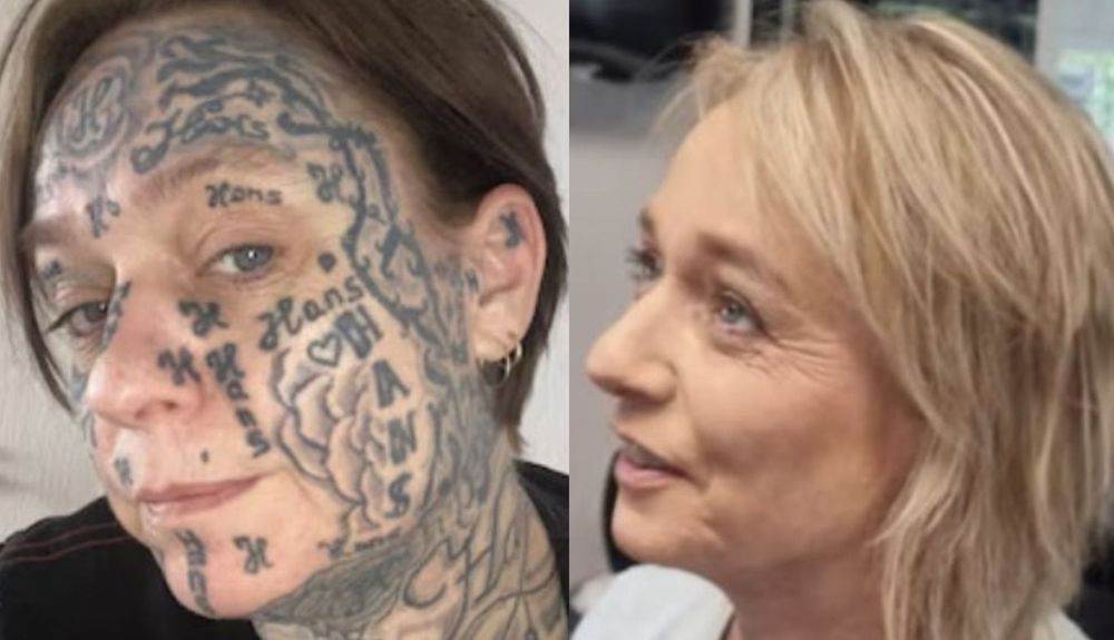 Forcée de se tatouer 250 fois de son compagnon, une Néerlandaise récupère son visage