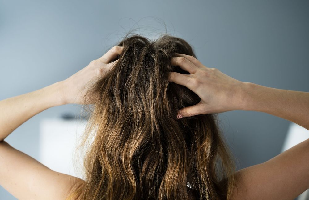 Psoriasis à la racine des cheveux : ces gestes surprenants du quotidien qui peuvent le déclencher
