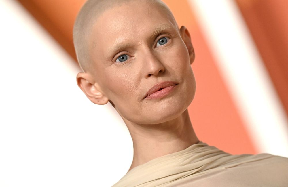 « Un diagnostic ne signifie pas la fin de la beauté » : exclue du défilé Victoria’s Secret, Bianca Balti se confie sans filtre