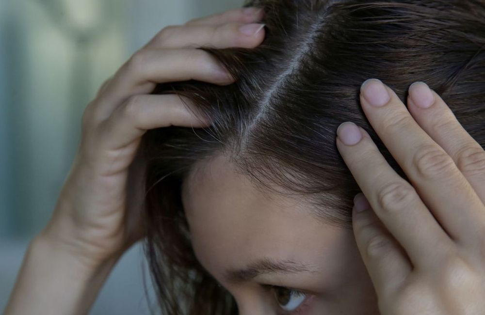 Pourquoi les 20-30 ans ont-ils des cheveux blancs de plus en plus tôt ?