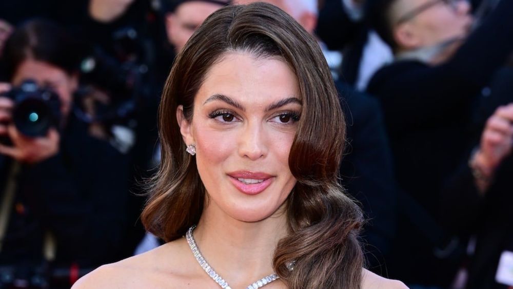 Iris Mittenaere (32 ans) le visage amoché : "Je décide de ne pas vous le cacher"