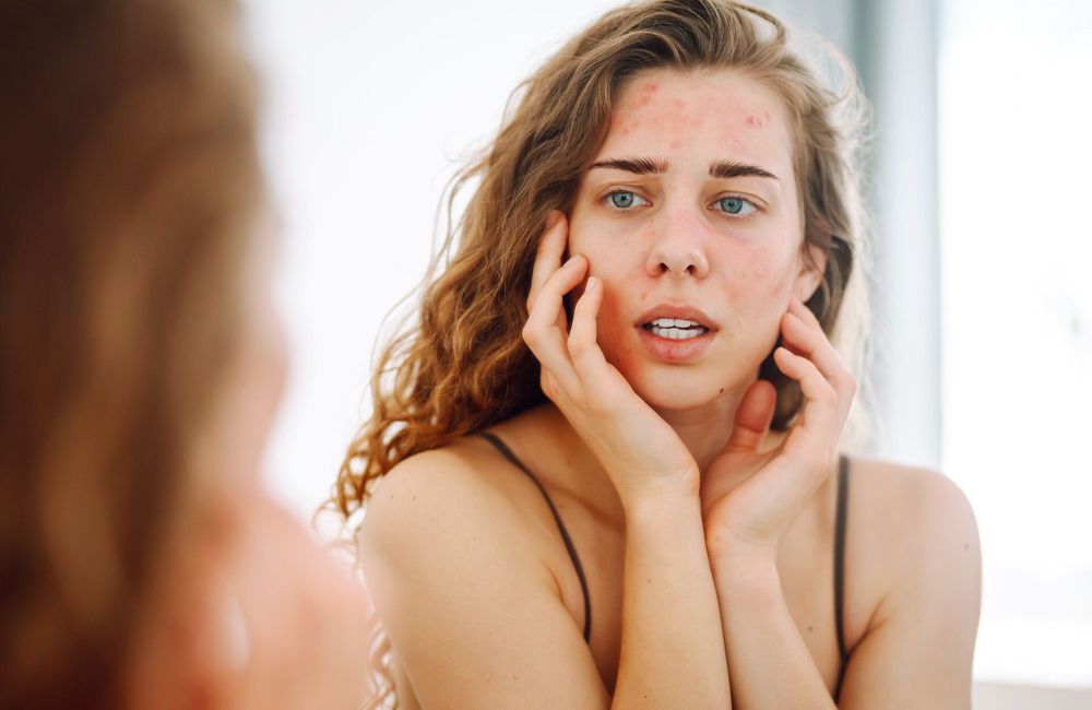 « La peau a une mémoire » : une biochimiste alerte sur l'excès d'acides et de rétinoïdes