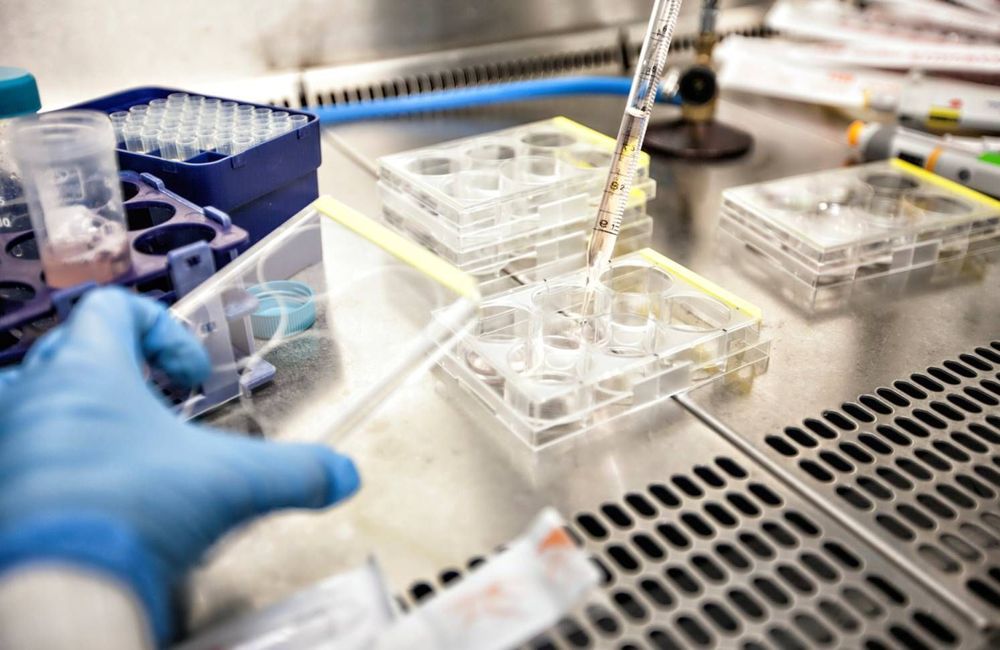 VIH : une étude révèle pourquoi certains patients peuvent vivre avec le virus sans traitement
