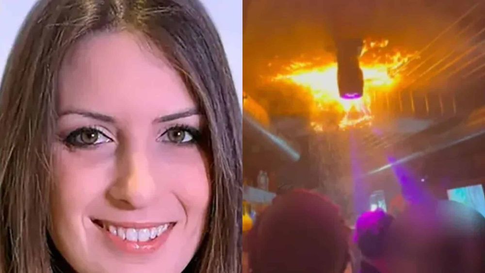 Incendie de Crans-Montana : une victime se montre défigurée par les brûlures et témoigne, regardez !
