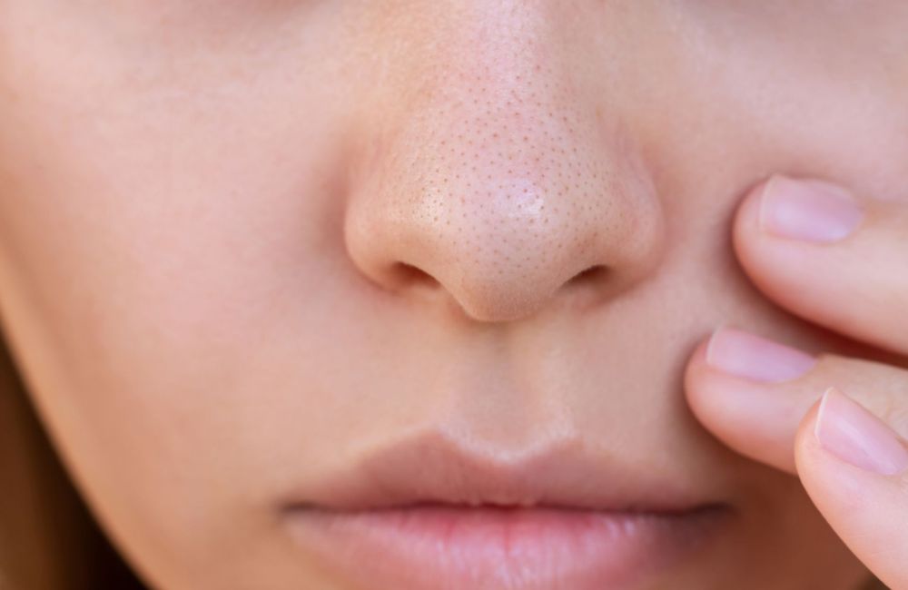 Qu'est-ce que les filaments sébacés, ces imperfections semblables aux points noirs (et comment en venir à bout) ?
