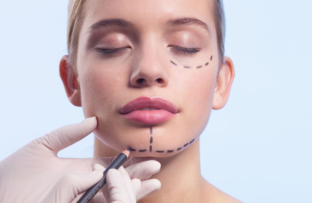 Menton fuyant, profil déséquilibré… Pourquoi la technique du Chin Filler est-elle de plus en plus demandée en médecine esthétique ?