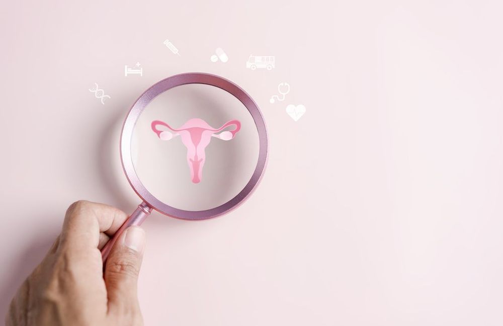 Une endométriose sévère expose à 10 fois plus de risque de contracter un cancer de l’ovaire