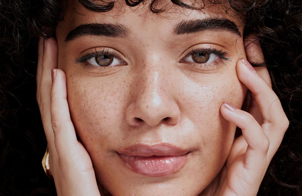 Acné : les femmes plus touchées que les hommes dans le monde