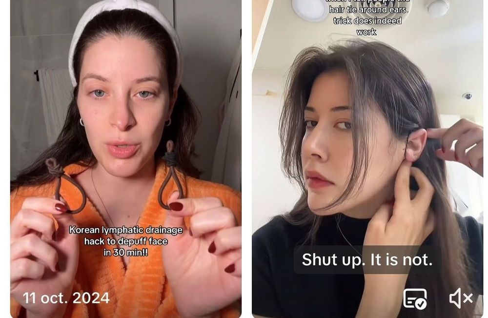 Visage gonflé, mine bouffie… Pourquoi les filles s’attachent-elles les oreilles sur les réseaux sociaux ?