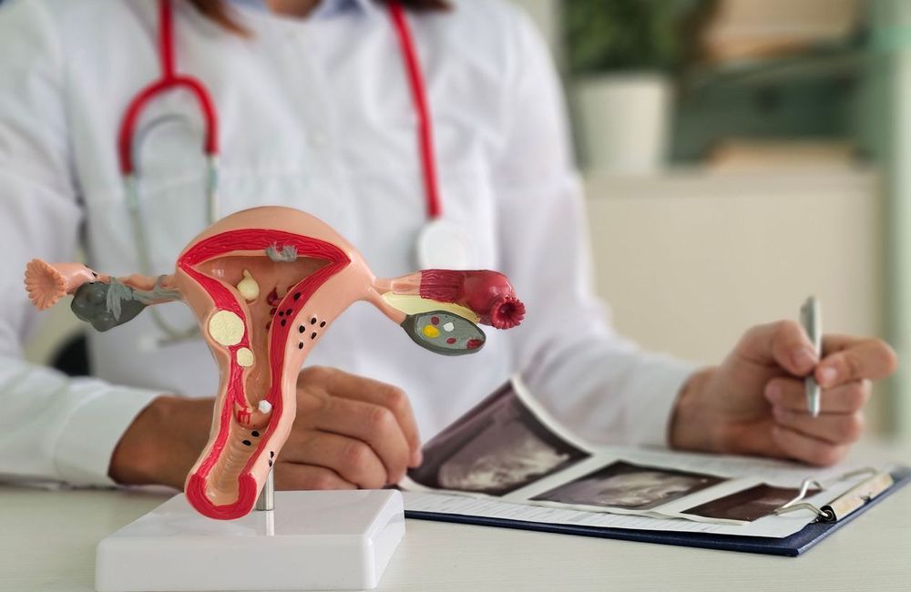 Endométriose : comment la diagnostiquer ?