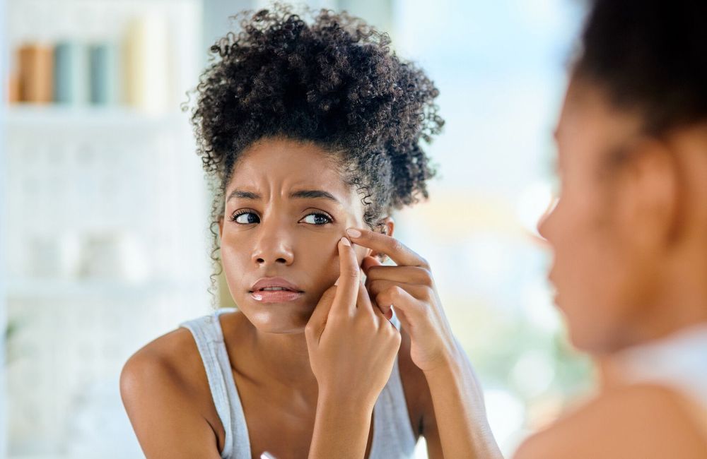L’astuce express d’un dermatologue pour éradiquer un bouton d’acné