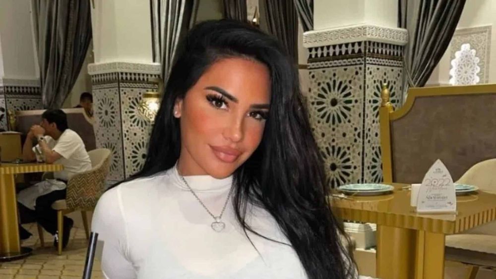 "Horrible" : Milla Jasmine refait des injections au visage, les internautes sous le choc !