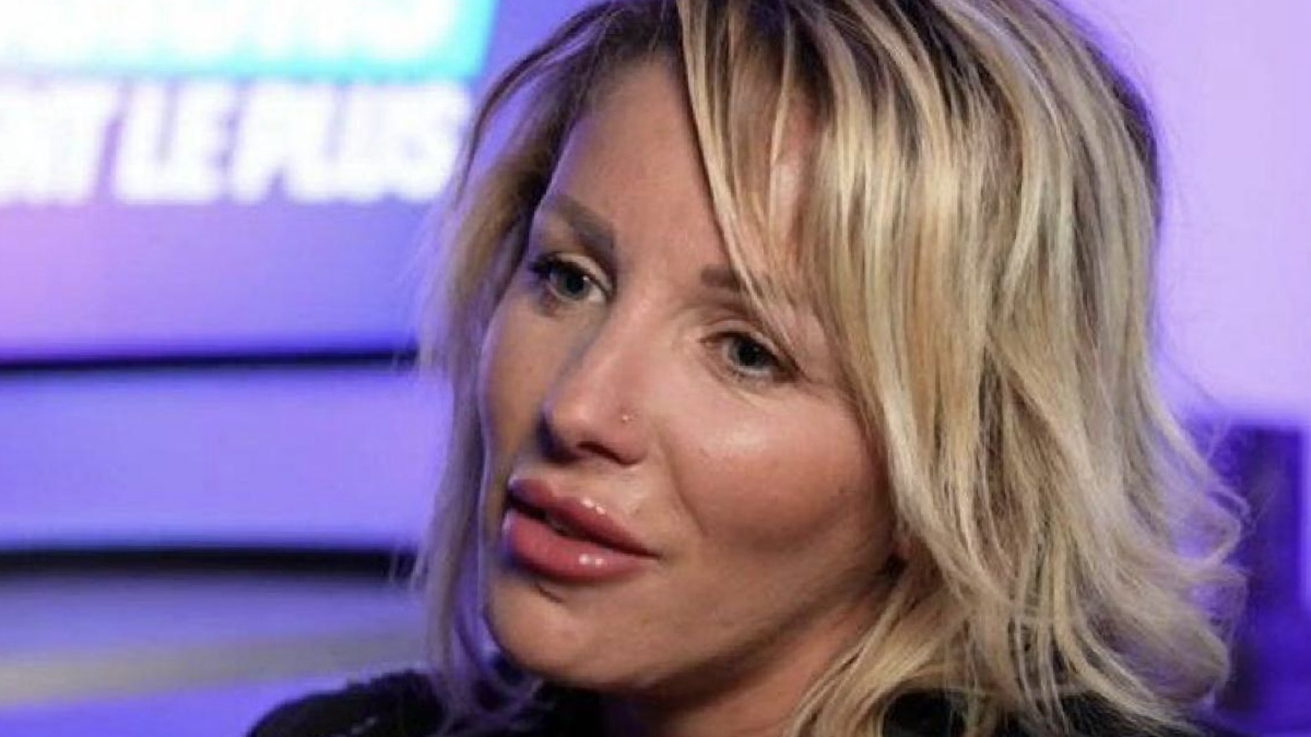 Myriam Abel gonflée par des injections au visage : « j’avoue que cette photo fait flipper »